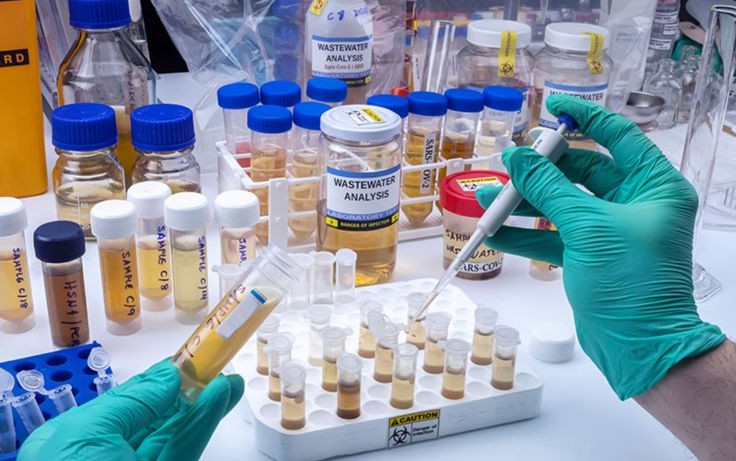 Laboratory Supply and Training